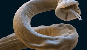 El parásito Ascaris en el cuerpo humano.