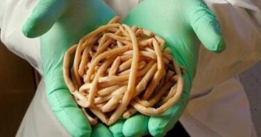 parásitos extraídos del cuerpo humano