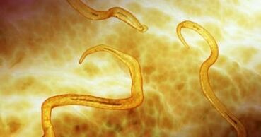 parásitos oxiuros en el cuerpo humano