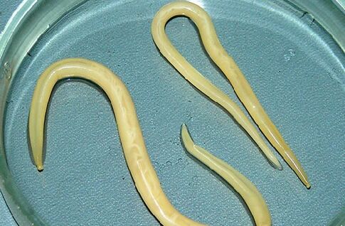 lombrices intestinales del cuerpo de un niño