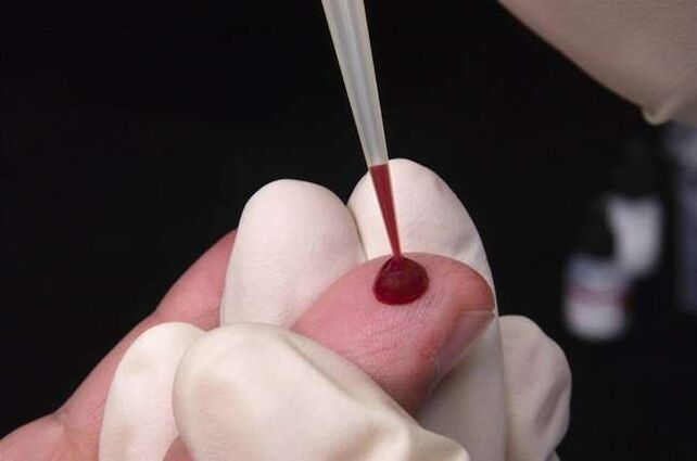extracción de sangre para análisis de parásitos