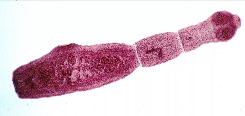 Echinococcus es uno de los parásitos más peligrosos para los humanos. 