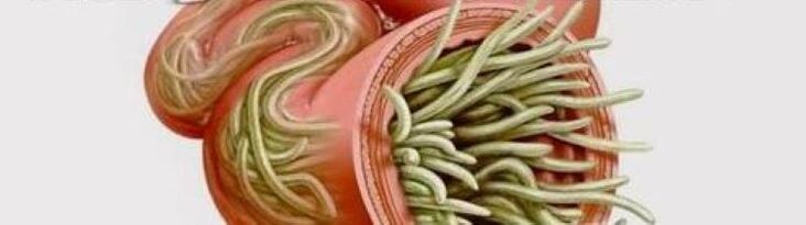 los gusanos redondos viven en el intestino delgado