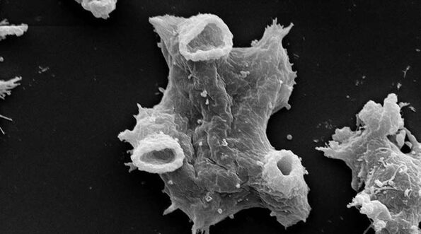 Negleria fowlera es un parásito protozoario peligroso para la vida humana. 